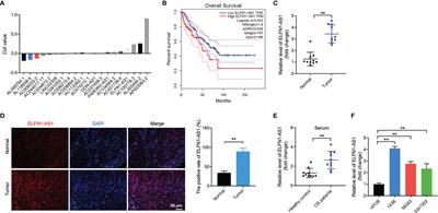 Osteosarcoma Cell-Derived Exosomal ELFN1-AS1 Mediates Macrophage M2 Polarization via Sponging miR-138-5p and miR-1291 to Promote the Tumorgenesis of Osteosarcoma